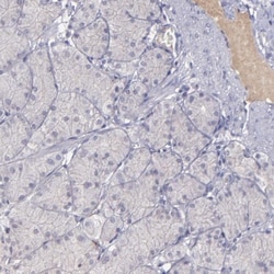 Complement Factor MASP3/MASP1 Antibody, Novus Biologicals 0.1mL; Unlabeled:Antibodies,